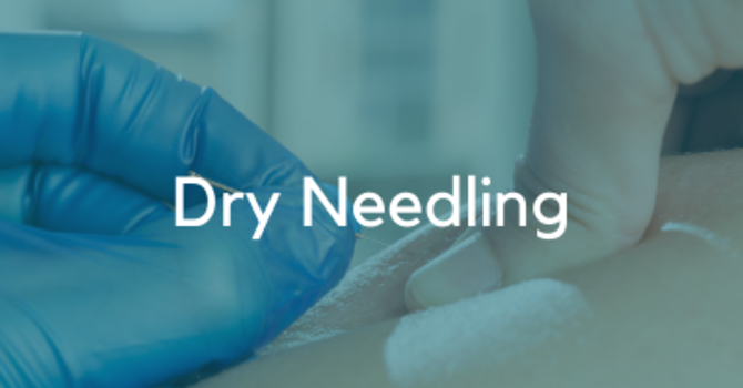 Dry Needling Treatments